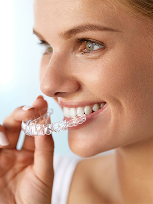 clear aligners